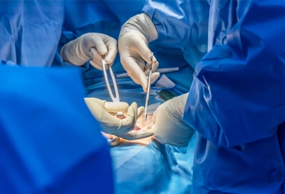 What is Circumcision? Understanding The Procedure, Benefits, And Risks